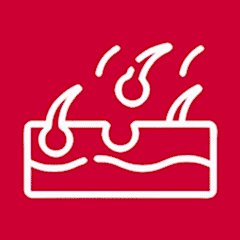 Заболевания кожи, аллергические реакции, пищевая непереносимость